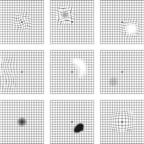 amsler grid interpretation